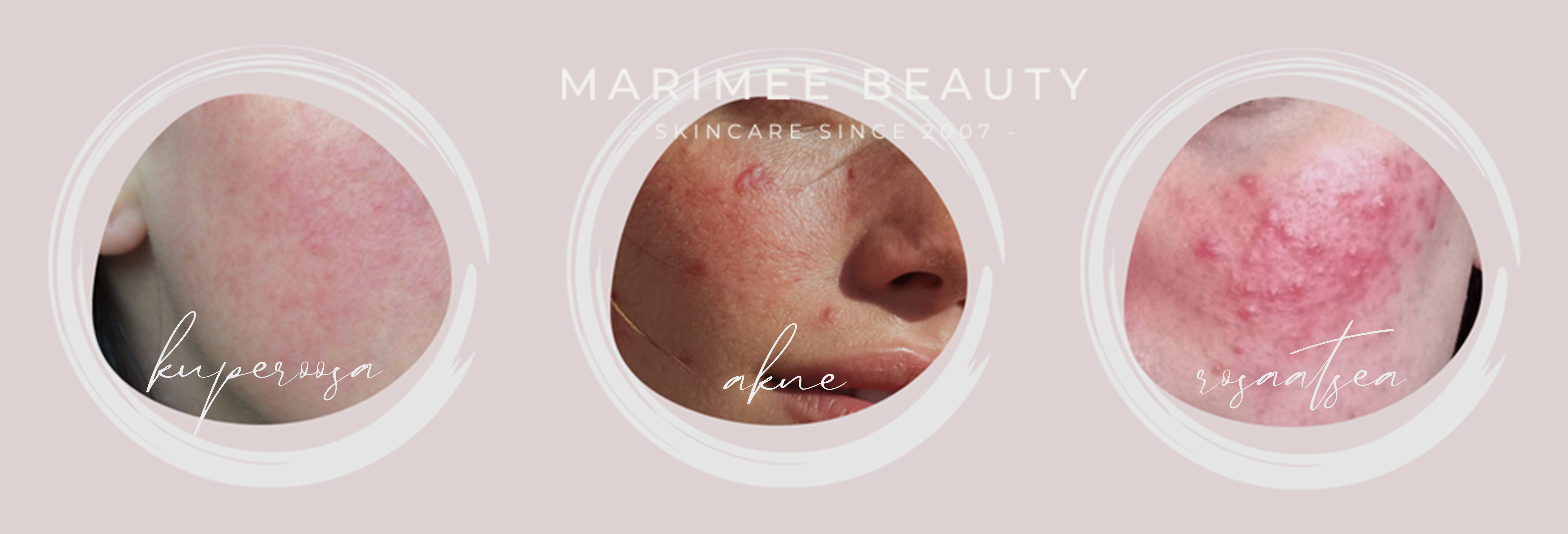 Marimee beauty- Akne ja ROS-slaid.jpg (1.30 MB)